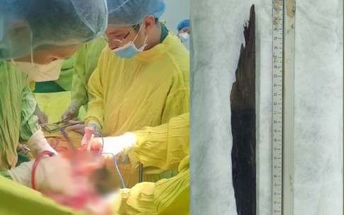 Tin 23/11: Bé gái suýt hoại tử mũi vì pin đồ chơi; Trang Nemo ôm bạn của Trần My xin lỗi tại tòa