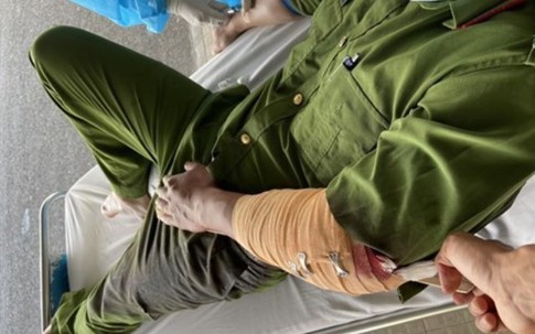 Đến hiện trường giải quyết mâu thuẫn, phó Trưởng công an phường bị chém