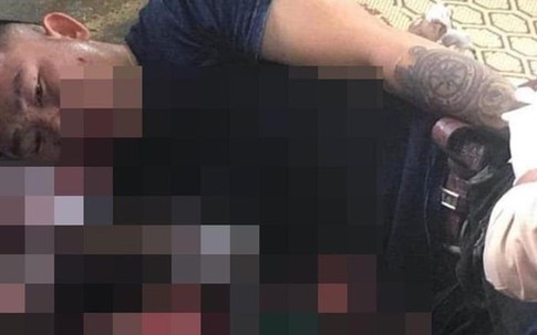 Nghệ An: Một thanh niên bị thương rất nặng nghi do pháo nổ