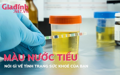 Màu nước tiểu nói gì về tình trạng sức khoẻ của bạn?