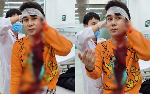 Nam diễn viên trong phim "Thương ngày nắng về" bị chém nhập viện