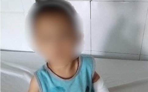 Níu kéo người yêu bất thành, gã đàn ông cắt đứt gân tay cháu bé 4 tuổi