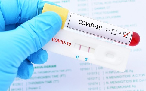 Bác sĩ chỉ cách tiết kiệm test nhanh khi tự xét nghiệm Covid-19 tại nhà