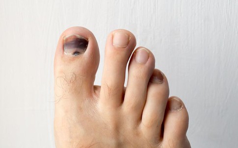 Người sống lâu thường có 4 đặc điểm ở bàn chân, nếu có đủ thì quá tuyệt vời luôn!