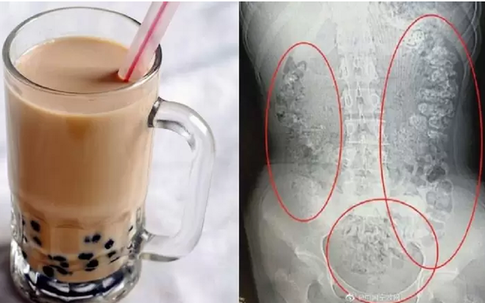 Từ vụ nữ sinh nhập viện sau khi uống trà sữa, chuyên gia khuyến cáo chỉ cần uống 1 ly cũng nhất định phải làm việc này