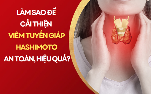 Hiểu đúng về viêm tuyến giáp Hashimoto để điều trị hiệu quả