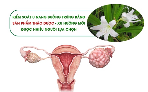 Kiểm soát u nang buồng trứng bằng sản phẩm thảo dược - Xu hướng mới được nhiều người lựa chọn