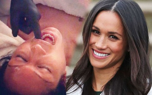 Để níu giữ tuổi xuân, Meghan Markle thực hiện liệu pháp khiến người ta ''mắt tròn mắt dẹt''