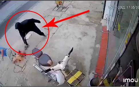Người đàn ông Hà Nội bất ngờ bị chém đứt lìa chân: Hành vi dã man nhưng chưa thuộc tội giết người?