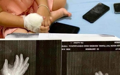Thanh Hoá: Nổ súng tại quán Karaoke, một cháu bé 4 tuổi bị đạn găm vào tay