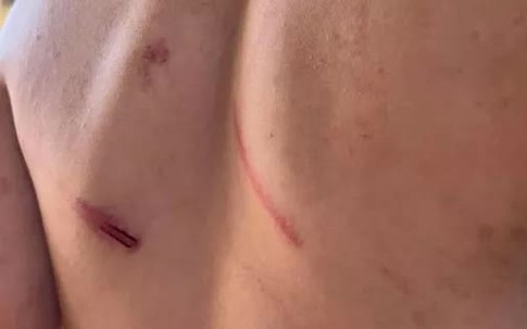 Cháu bé 9 tuổi bị bà và cha đánh đập dã man