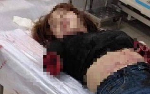 Chuyện rùng rợn tại Đồng Nai: Vợ bị chồng chém đứt lìa hai tay vì ghen tuông