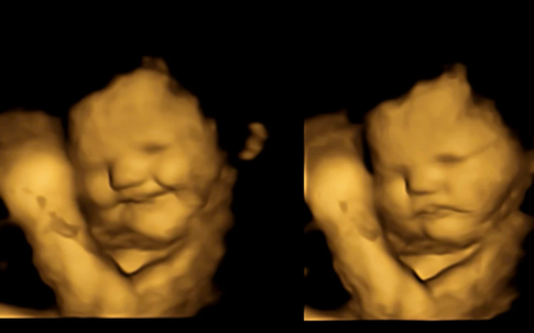 Bất ngờ về vẻ mặt của thai nhi trong bụng mẹ