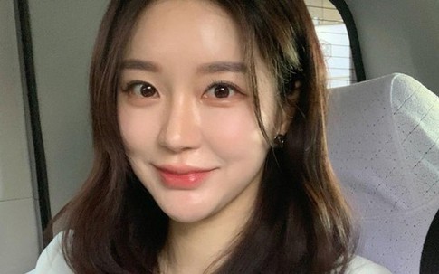 5 cách khắc phục nền da bị nám nhẹ, áp dụng đầy đủ sẽ giúp da đều màu hơn