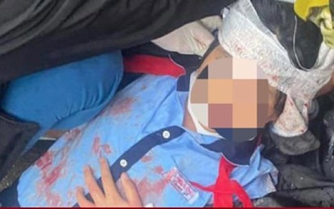 Nữ sinh lớp 6 bị gã thanh niên dùng búa đánh vào đầu: Thông tin mới nhất