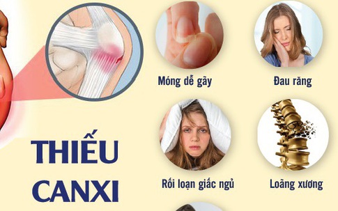 Không chỉ đau xương khớp, có dấu hiệu này cần nghĩ ngay đến thiếu canxi, đây là 3 'thủ phạm' chính bòn rút canxi trong cơ thể bạn