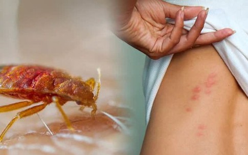 Cách phòng chống và diệt loài rệp giường