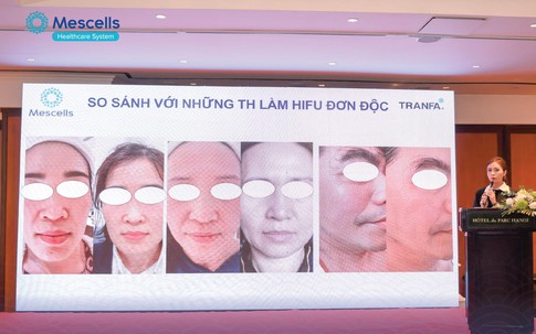 Workshop 2023 với chủ đề “Centerless Focused Ultrasound - Công nghệ sóng siêu âm hội tụ đến từ Châu Âu 