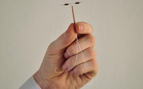 Vòng tránh thai đi lạc chỗ - Chú ý những bất thường để phát hiện sớm