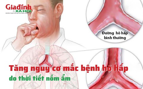 Tăng nguy cơ mắc bệnh hô hấp do thời tiết nồm ẩm