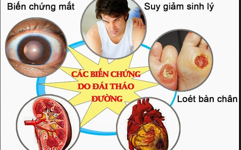 Bị cắt cụt 2 bàn chân do bệnh tiểu đường, chuyên gia cảnh báo người bệnh tuyệt đối không chủ quan với 5 biến chứng này!