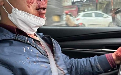 Đi làm về, thầy giáo bị kẻ xấu hành hung cướp tài sản