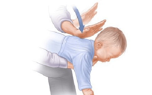 Trẻ 2 tháng tuổi tử vong nghi do sặc sữa, bác sĩ chỉ ra những việc cần làm để phòng tránh tai nạn này ở trẻ