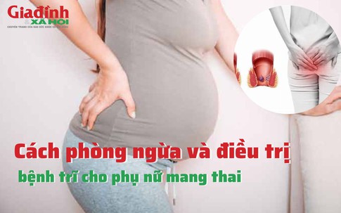 Cách phòng ngừa và điều trị bệnh trĩ cho phụ nữ mang thai