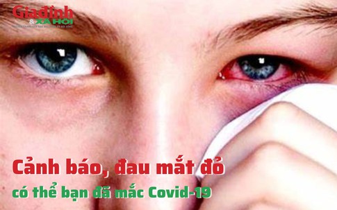 Cảnh báo, đau mắt đỏ có thể bạn đã mắc COVID-19