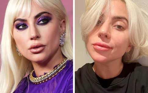 Bí quyết chăm sóc da trẻ mãi không già của Lady Gaga