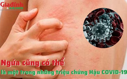 Ngứa cũng có thể là một trong những triệu chứng Hậu COVID-19 