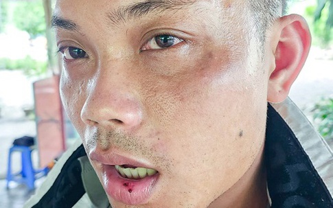 Làm việc với nhóm thanh niên bị tố đánh du khách ở Nha Trang