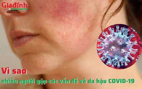 Vì sao nhiều người gặp các vấn đề về da hậu COVID-19