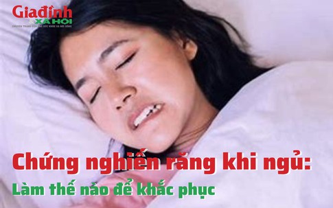 Làm thế nào để khắc phục chứng nghiến răng khi ngủ?