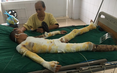 MS 851: Mẹ bầu 3 tháng khóc ngất cầu xin mọi người cứu con trai bỏng nặng vì điện giật