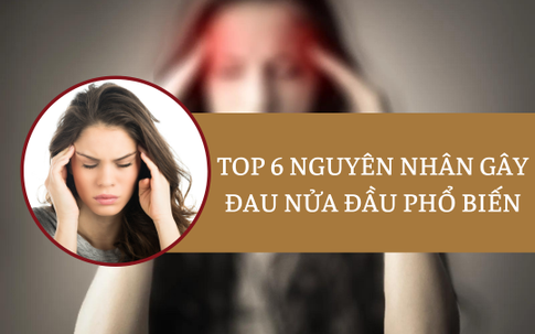 Top 4 nguyên nhân đau nửa đầu và cách khắc phục hiệu quả ngay tại nhà