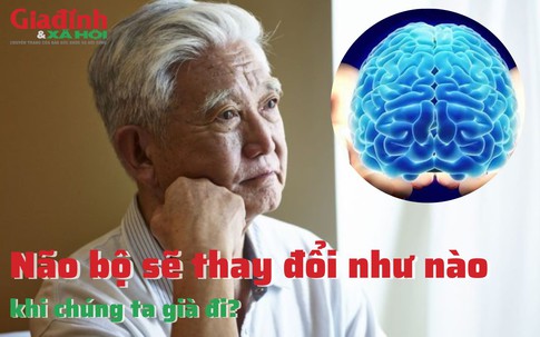 Não bộ sẽ thay đổi như nào khi chúng ta già đi?