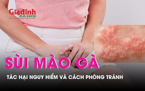 Sùi mào gà bệnh lý ngày càng tăng cao, tác hại nguy hiểm và cách phòng tránh