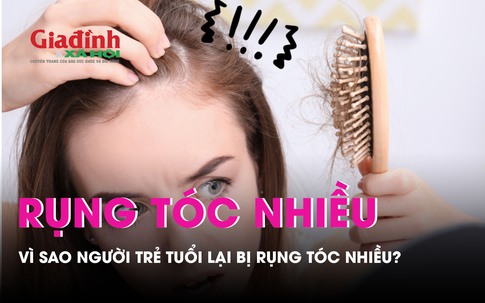 Vì sao người trẻ tuổi lại bị rụng tóc nhiều?