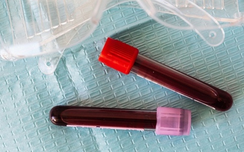 'Đổ vỏ' cho người khác, người đàn ông nhận cái kết đau lòng