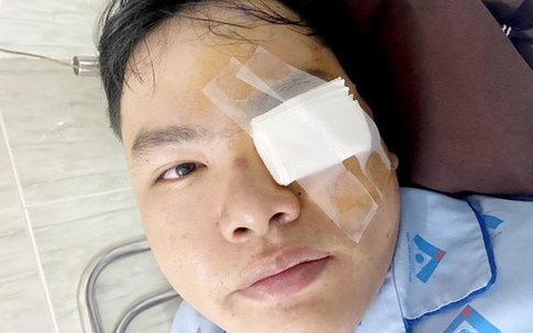 Xác minh, làm rõ đơn khiếu nại vụ nam thanh niên tố bị gậy CSGT 'va' vào mắt