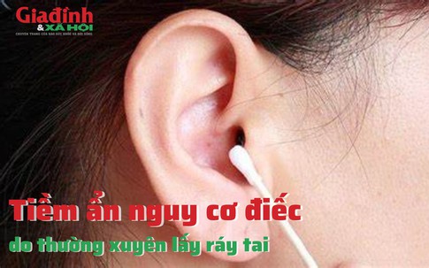 Tiềm ẩn nguy cơ điếc do thường xuyên lấy ráy tai