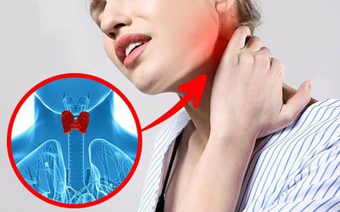 Nữ sinh 19 tuổi mắc ung thư tuyến giáp chỉ vì thường xuyên làm thói quen này, ai không có xin chúc mừng