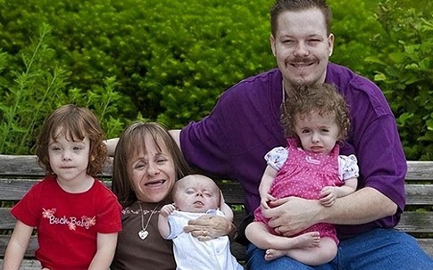 Người phụ nữ cao 70cm lấy 'soái ca' cao 180cm, ba lần mạo hiểm sinh con