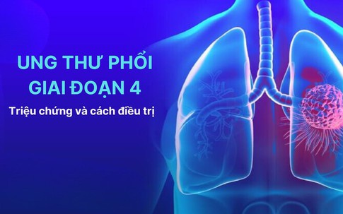 U phổi là gì? Triệu chứng và cách cải thiện
