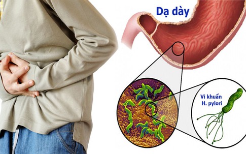 Bé 13 tuổi ói ra máu vì nhiễm khuẩn HP, khuyến cáo cha mẹ cần làm điều này để phòng bệnh cho trẻ