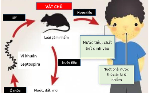 Sốt cao liên tục, 2 trẻ nhập viện trong tình trạng nặng vì nhiễm loại xoắn khuẩn nguy hiểm