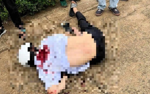 Nam sinh lớp 11 bị đâm trọng thương, hai học sinh bị khởi tố