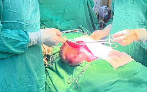 Bé gái 15 tuổi có khối u buồng trứng ác tính, dấu hiệu nào giúp cha mẹ nhận biết?