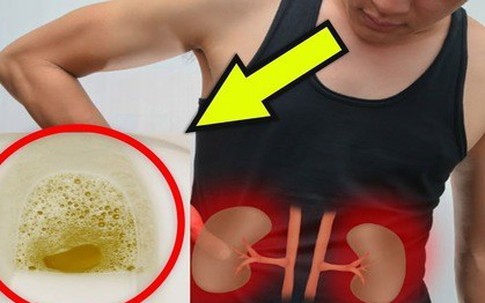 Sau tuổi 60, nếu có 4 triệu chứng này khi đi tiểu chứng tỏ bạn dễ mắc bệnh thận, tuổi thọ ngắn